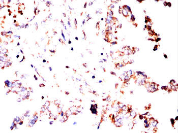 EPN1 Antibody