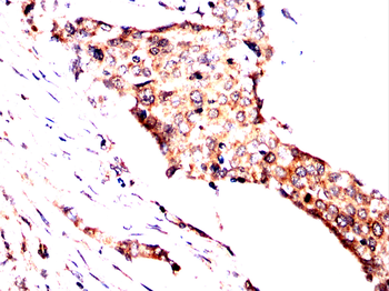 EPN1 Antibody