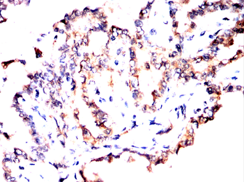 EPN1 Antibody
