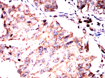 PELO Antibody