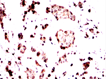 MDM2 Antibody