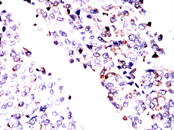 MDM2 Antibody