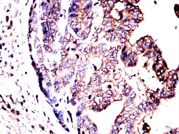 MDM2 Antibody
