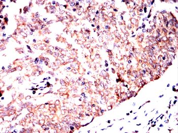 MDM2 Antibody