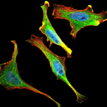 CALR Antibody