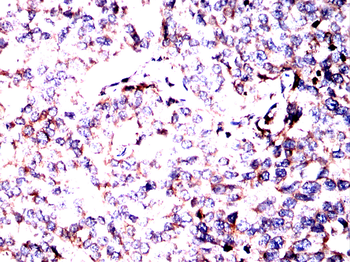 CALR Antibody