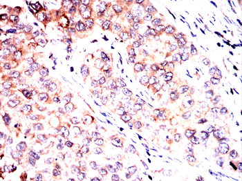 CALR Antibody