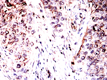 CALR Antibody