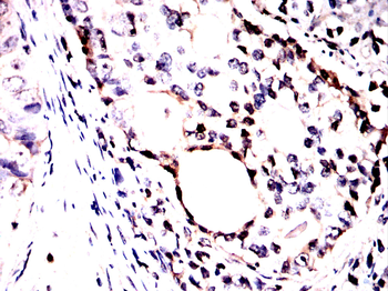 CALR Antibody