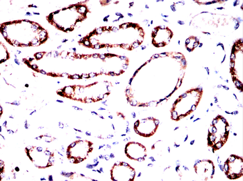 TH Antibody