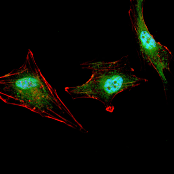TH Antibody