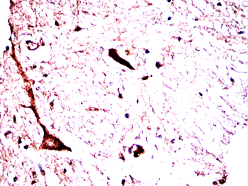 TH Antibody