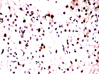 TH Antibody