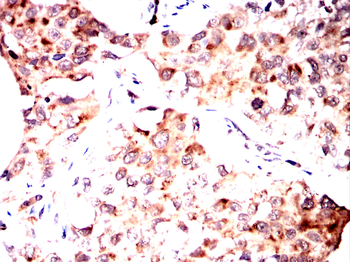 TH Antibody