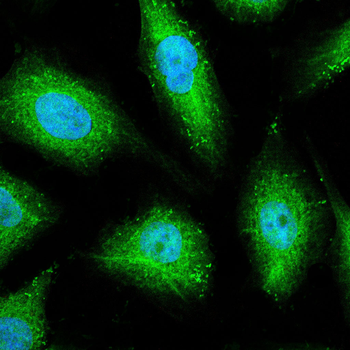 VTI1B Antibody