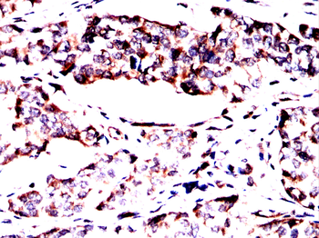 VTI1B Antibody