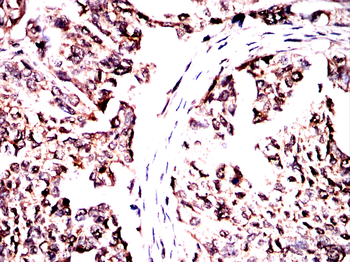 VTI1B Antibody