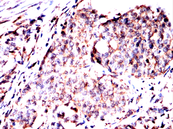 VTI1B Antibody