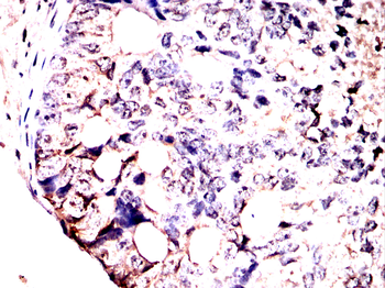 VTI1B Antibody