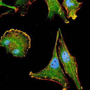 VTI1B Antibody