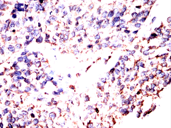 VTI1B Antibody