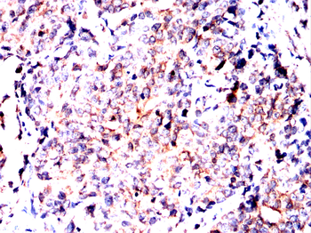 VTI1B Antibody
