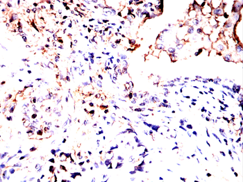 VTI1B Antibody
