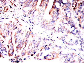 VTI1B Antibody
