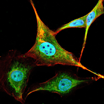 ACTN4 Antibody