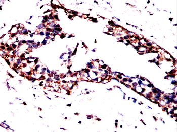 ACTN4 Antibody