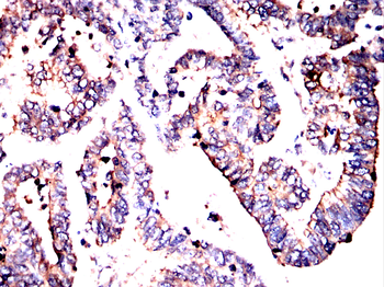 ACTN4 Antibody