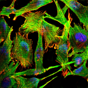 ACTN4 Antibody