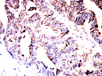 ACTN4 Antibody