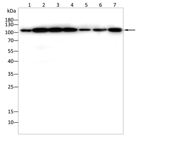 ACTN4 Antibody