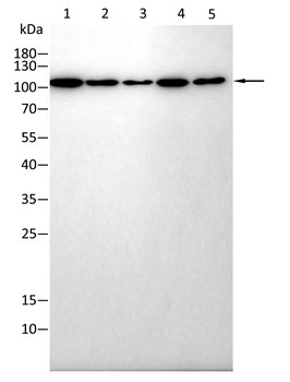 ACTN4 Antibody