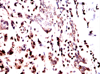 LMNB1 Antibody