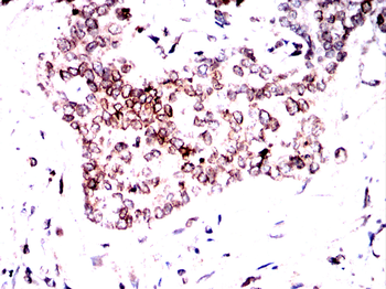 LMNB1 Antibody