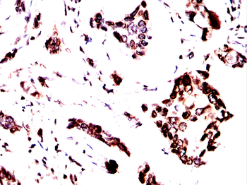 LMNB1 Antibody