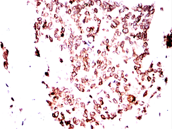 LMNB1 Antibody