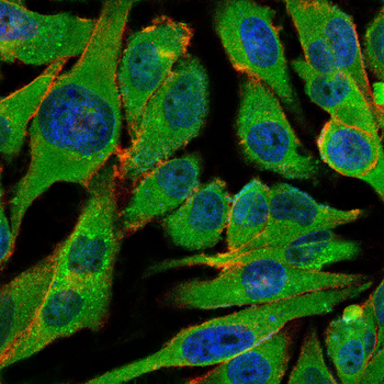 PLCG1 Antibody
