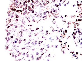 EGLN2 Antibody