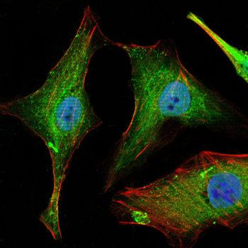 MMP14 Antibody