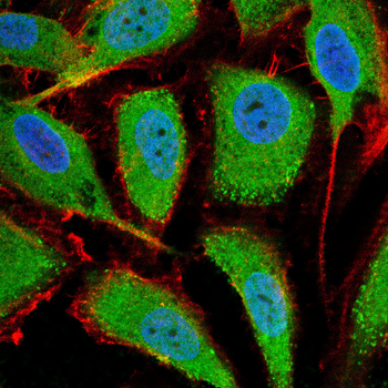 MMP14 Antibody