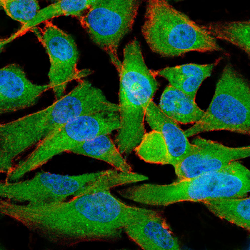 TREX1 Antibody