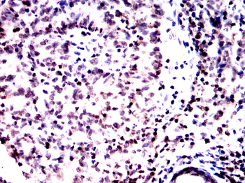 TREX1 Antibody