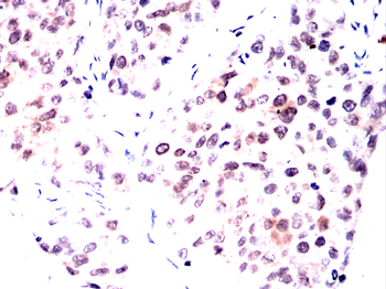 TREX1 Antibody