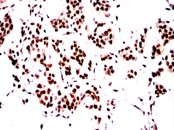 TREX1 Antibody