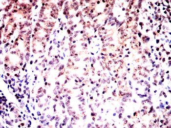 TREX1 Antibody