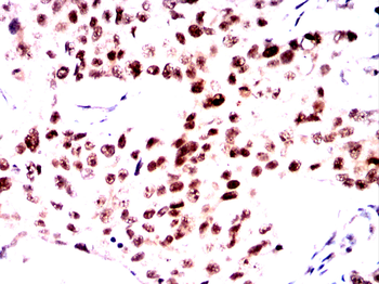 TREX1 Antibody