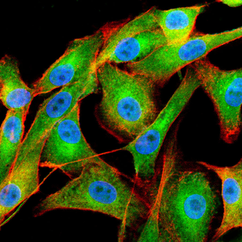 CAMK2A Antibody